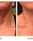 Restorative Neck Complex