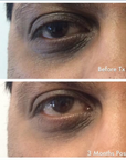 RX Repair Eye Cream