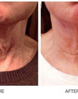 Restorative Neck Complex